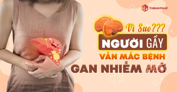 Vì sao người gầy vẫn có nguy cơ mắc bệnh gan nhiễm mỡ?
