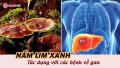 Tìm hiểu về tác dụng của nấm lim xanh đối với các bệnh lý về gan